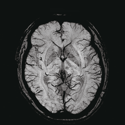専用出品！mri〜様 □当クリニックの放射線科 - あぜみち脳神経クリニック